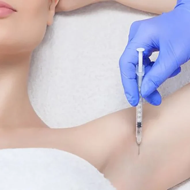 botox hiperhidrosis